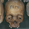 Patrice's Skull